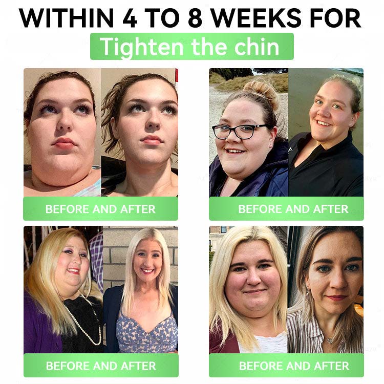 ✨️Alcuras_Moringa × Berberine × AMPK 8-Benefit Slimming & Metabolic Nano Microneedle Patch 🇺🇸  Just once a day · Visible changes in 7 days  ✅ For obesity, loose skin, diabetes, sleep apnea, joint issues, and more