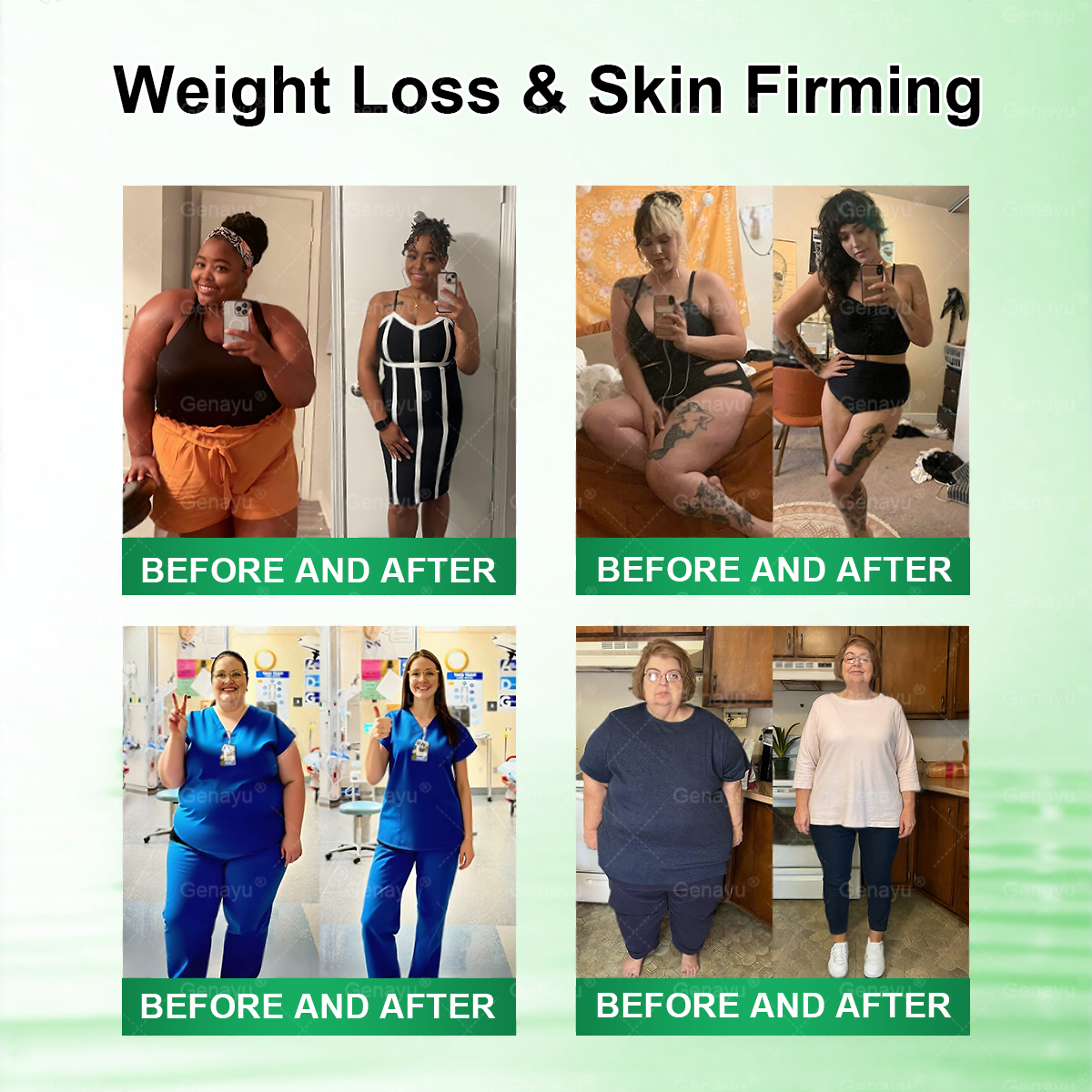 ✨️Alcuras_Moringa × Berberine × AMPK 8-Benefit Slimming & Metabolic Nano Microneedle Patch 🇺🇸  Just once a day · Visible changes in 7 days  ✅ For obesity, loose skin, diabetes, sleep apnea, joint issues, and more